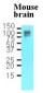 APP / Beta Amyloid Antibody (aa18-289, clone J4H9)